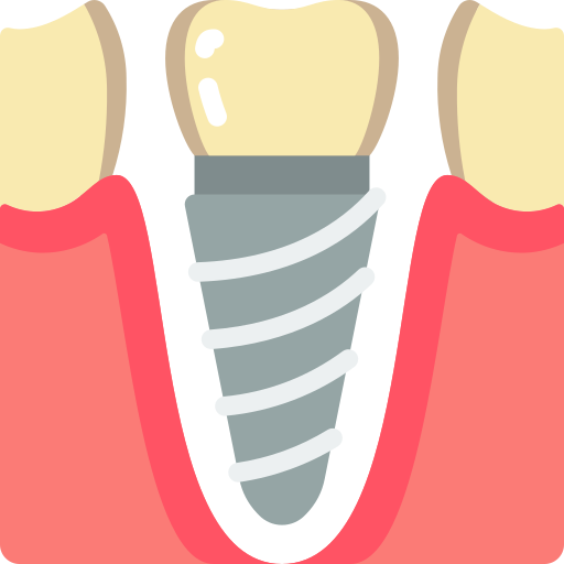 Implant Service