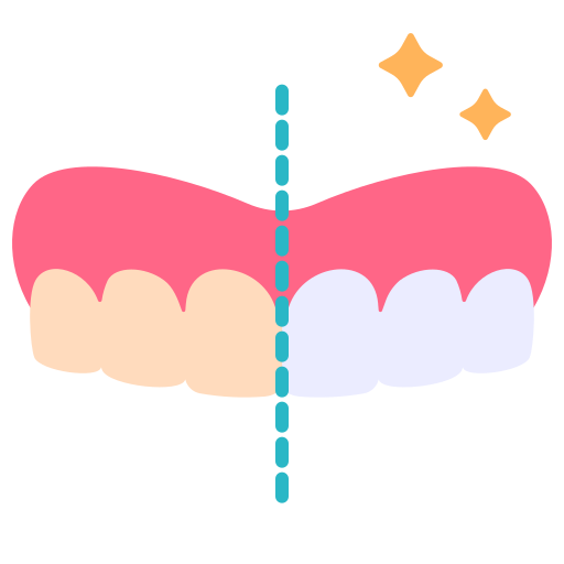 Teeth Whitening